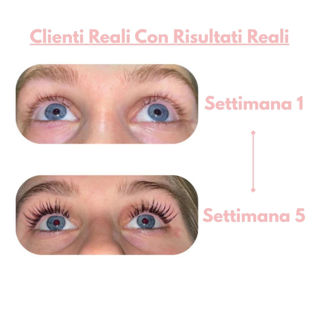 iLashy - Siero Allungante, Nutri Le Tue Ciglia!